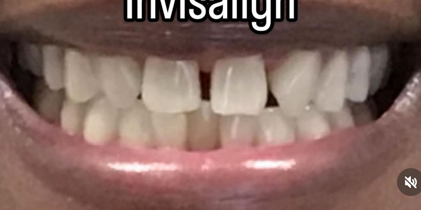 Smile Gallery
